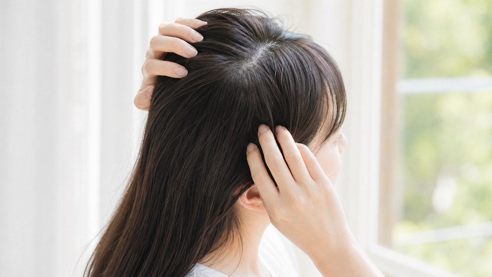 日焼けした頭皮の乾燥と髪のパサつきを気にする女性